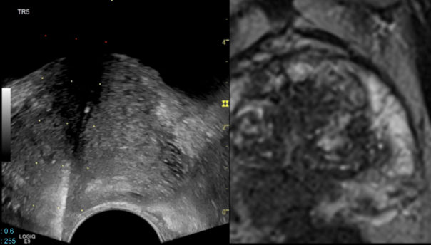 doc 9 image irm